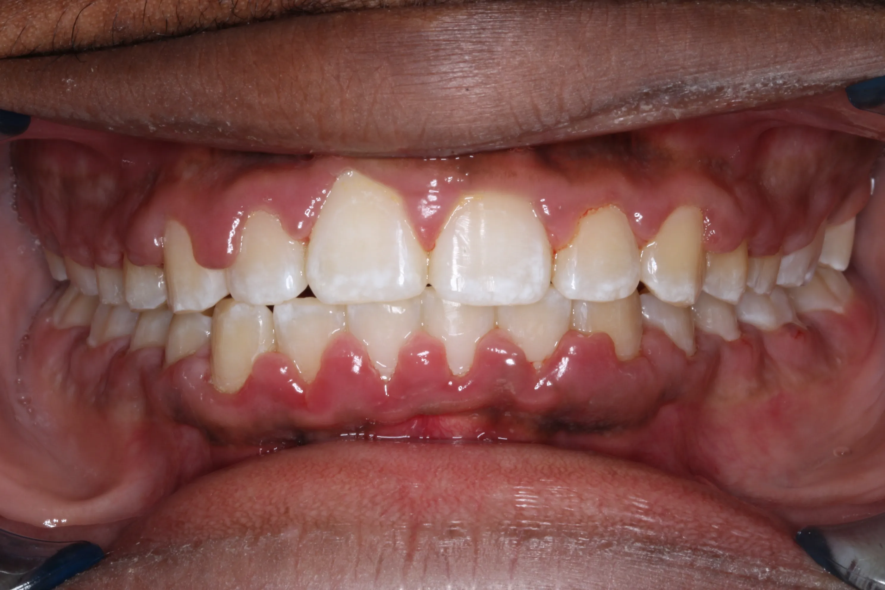 smile-gallery gallery